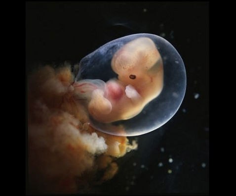 Семинедельный эмбрион.
