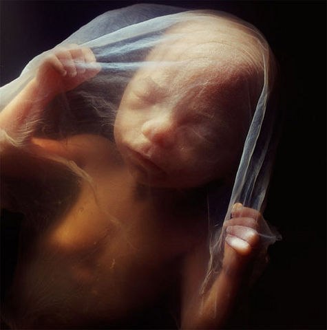 18- недельный эмбрион, уже распознает звуки и реагирует на внешний мир.