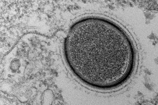 Новый тип гигантского вируса открыт международной группой ученых